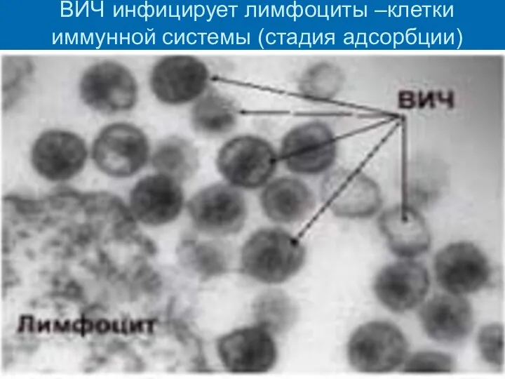 ВИЧ инфицирует лимфоциты –клетки иммунной системы (стадия адсорбции)