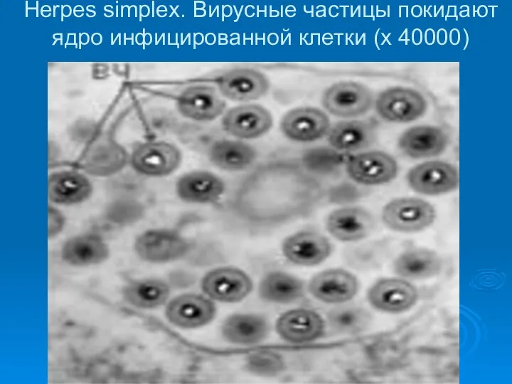 Herpes simplex. Вирусные частицы покидают ядро инфицированной клетки (х 40000)