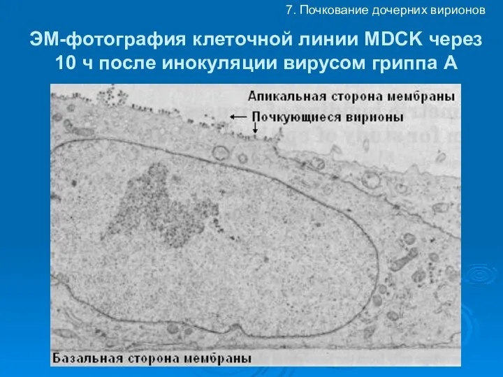 ЭМ-фотография клеточной линии MDCK через 10 ч после инокуляции вирусом гриппа А 7. Почкование дочерних вирионов