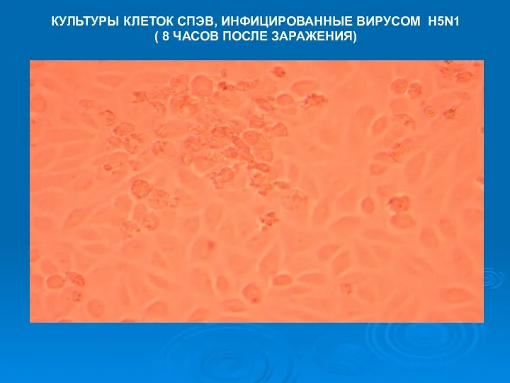 КУЛЬТУРЫ КЛЕТОК СПЭВ, ИНФИЦИРОВАННЫЕ ВИРУСОМ H5N1 ( 8 ЧАСОВ ПОСЛЕ ЗАРАЖЕНИЯ)