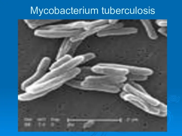 Mycobacterium tuberculosis