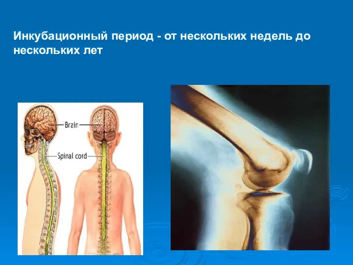 Инкубационный период - от нескольких недель до нескольких лет