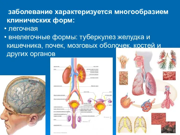 заболевание характеризуется многообразием клинических форм: легочная внелегочные формы: туберкулез желудка и