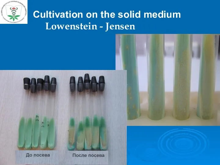 Cultivation on the solid medium Lowenstein - Jensen 27%