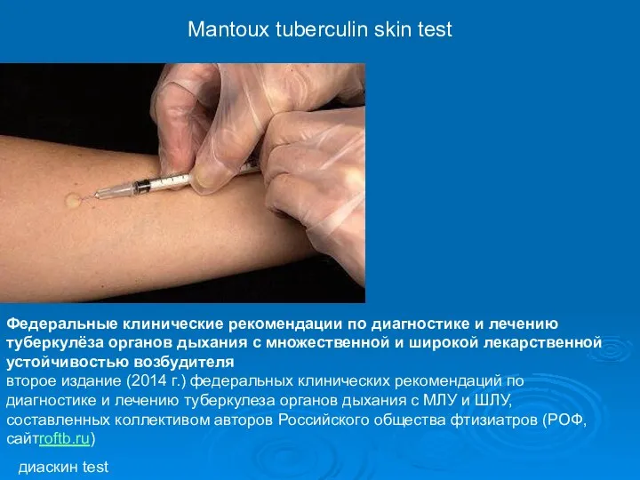 Mantoux tuberculin skin test диаскин test Федеральные клинические рекомендации по диагностике