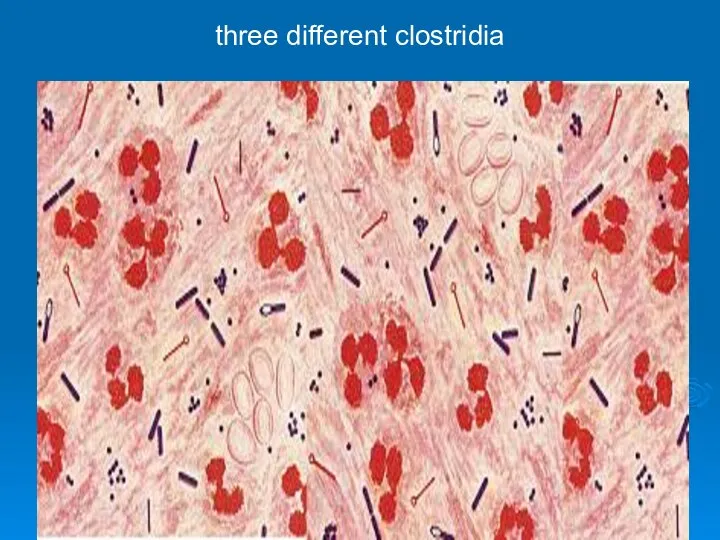 three different clostridia