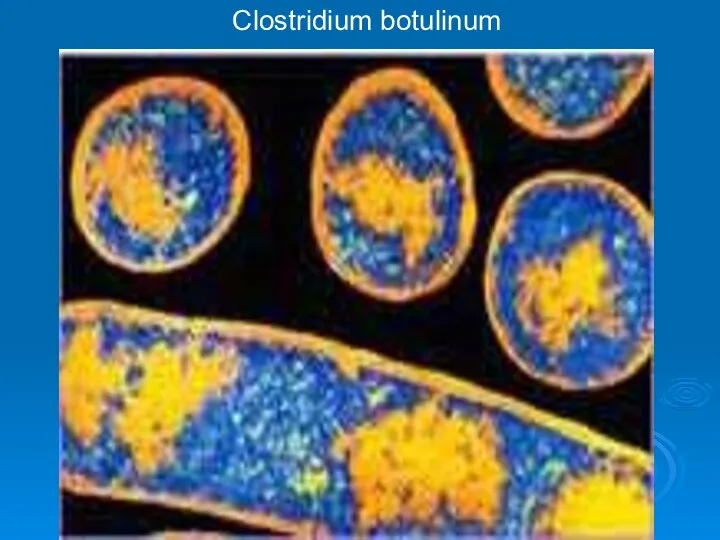 Clostridium botulinum