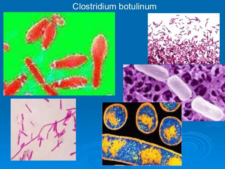 Clostridium botulinum