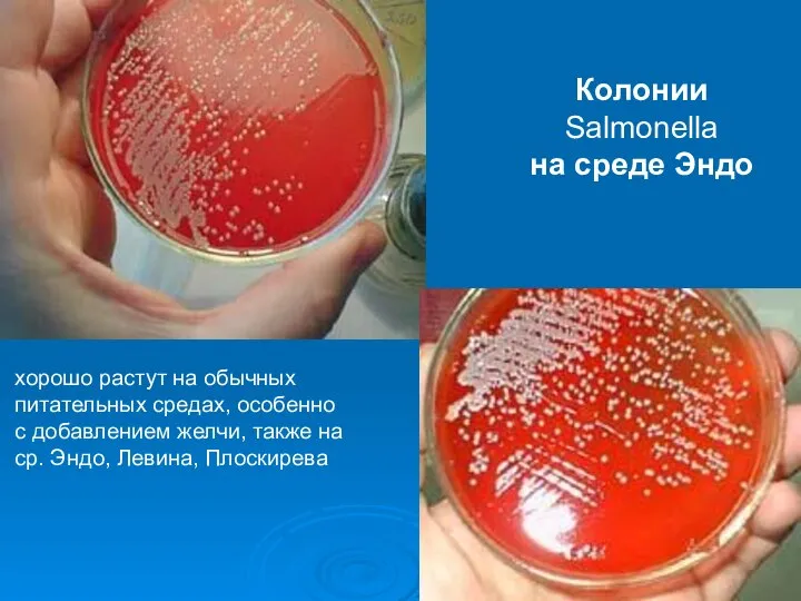 Колонии Salmonella на среде Эндо хорошо растут на обычных питательных средах,