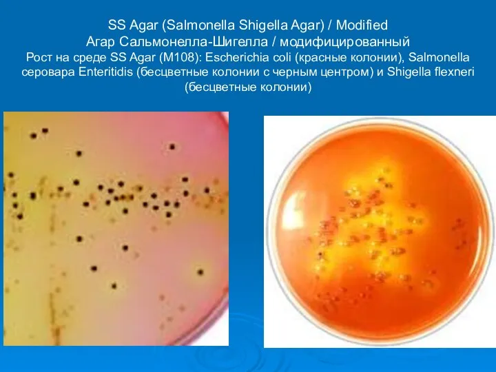 SS Agar (Salmonella Shigella Agar) / Modified Агар Сальмонелла-Шигелла / модифицированный