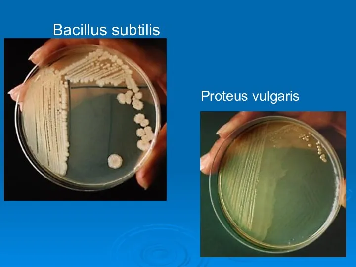 Bacillus subtilis Proteus vulgaris