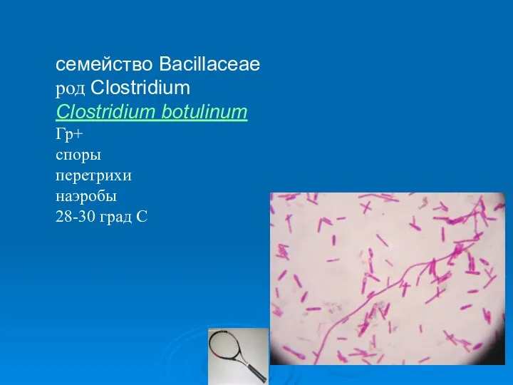 семейство Bacillaceae род Clostridium Clostridium botulinum Гр+ споры перетрихи наэробы 28-30 град С