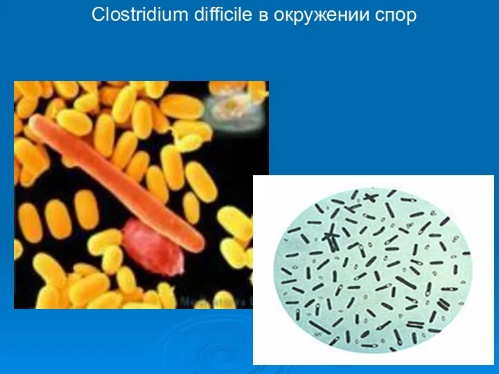 Clostridium difficile в окружении спор