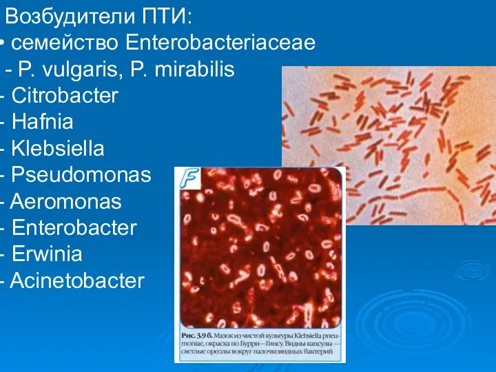 Возбудители ПТИ: семейство Enterobacteriaceae - P. vulgaris, P. mirabilis Citrobacter Hafnia