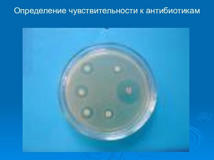 Определение чувствительности к антибиотикам