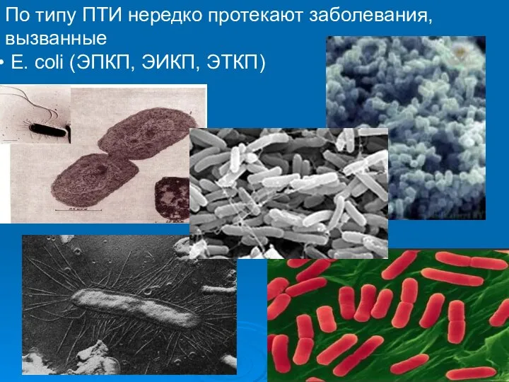 По типу ПТИ нередко протекают заболевания, вызванные E. coli (ЭПКП, ЭИКП, ЭТКП)