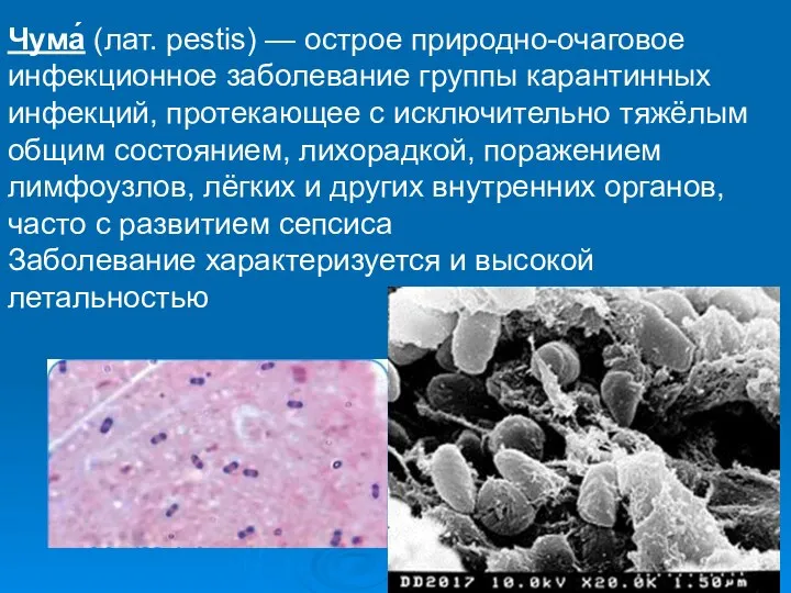 Чума́ (лат. pestis) — острое природно-очаговое инфекционное заболевание группы карантинных инфекций,