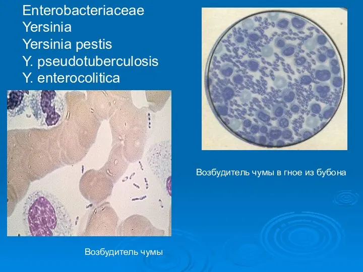 Возбудитель чумы Возбудитель чумы в гное из бубона Enterobacteriaceae Yersinia Yersinia pestis Y. рseudotuberculosis Y. enterocolitica