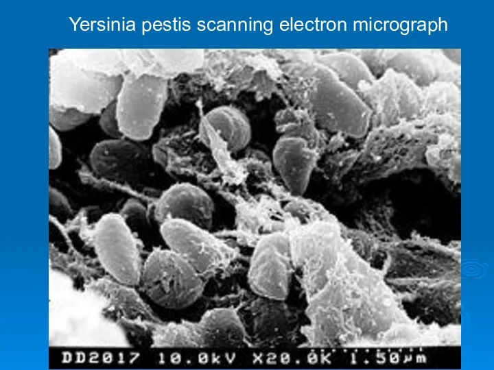 Yersinia pestis scanning electron micrograph