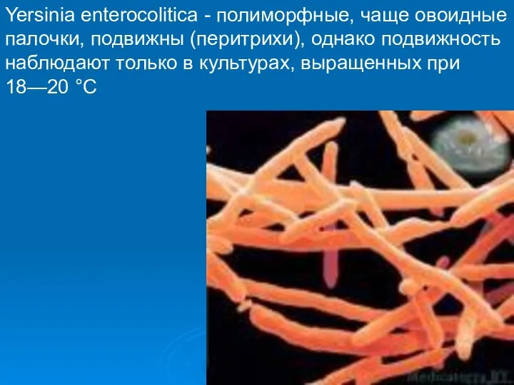 Yersinia enterocolitica - полиморфные, чаще овоидные палочки, подвижны (перитрихи), однако подвижность