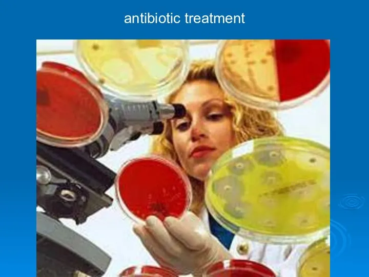 antibiotic treatment