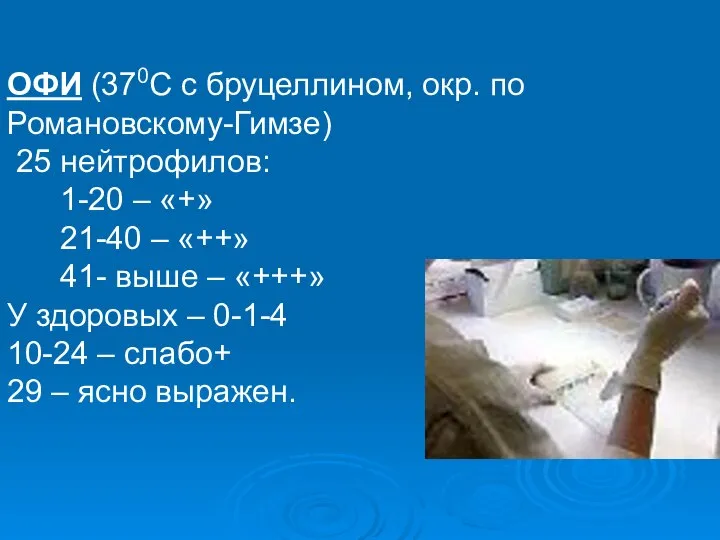 ОФИ (370С с бруцеллином, окр. по Романовскому-Гимзе) 25 нейтрофилов: 1-20 –