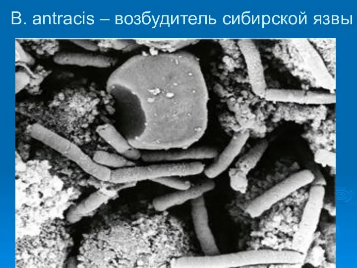 B. аntracis – возбудитель сибирской язвы