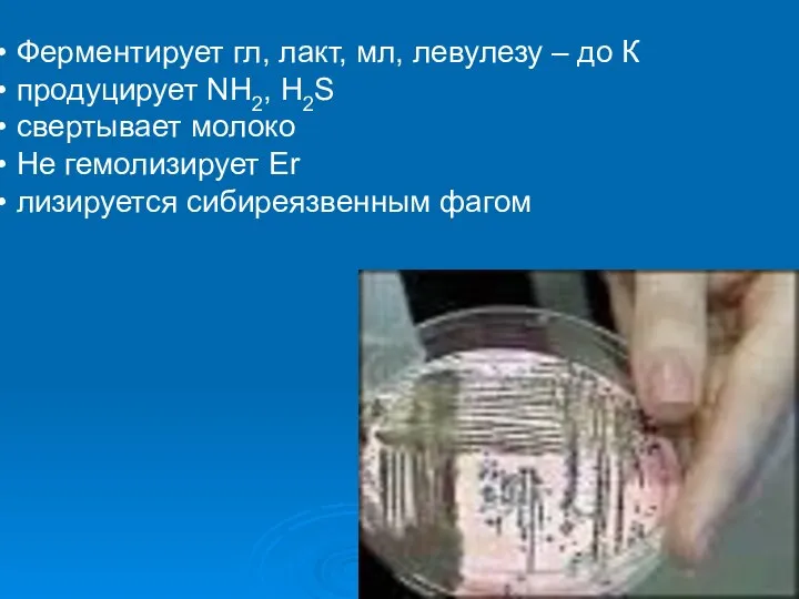 Ферментирует гл, лакт, мл, левулезу – до К продуцирует NH2, H2S