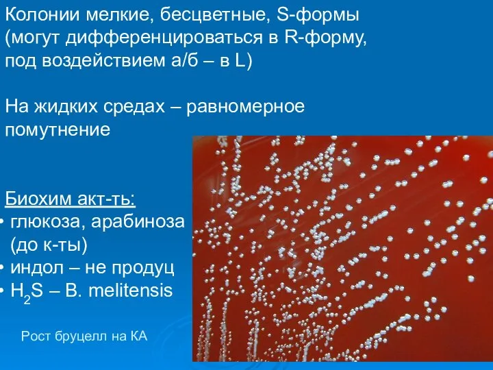 Рост бруцелл на КА Колонии мелкие, бесцветные, S-формы (могут дифференцироваться в