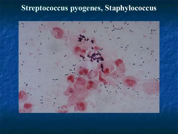 Streptococcus pyogenes, Staphylococcus