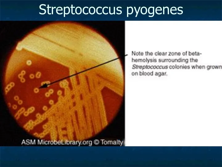 Streptococcus pyogenes