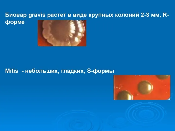 Биовар gravis растет в виде крупных колоний 2-3 мм, R-форме Mitis - небольших, гладких, S-формы