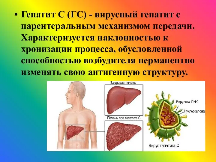 Гепатит С (ГС) - вирусный гепатит с парентеральным механизмом передачи. Характеризуется