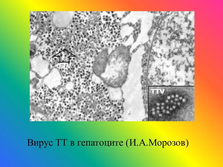 Вирус ТТ в гепатоците (И.А.Морозов)