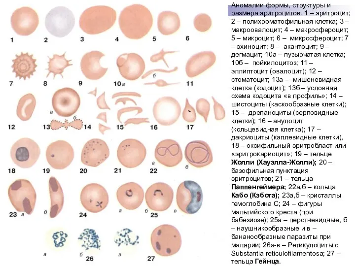 Аномалии формы, структуры и размера эритроцитов. 1 – эритроцит; 2 –