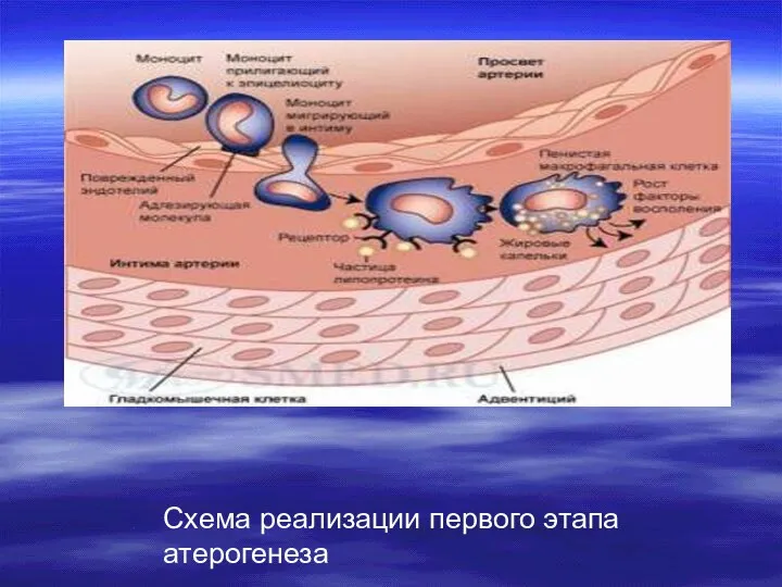Схема реализации первого этапа атерогенеза