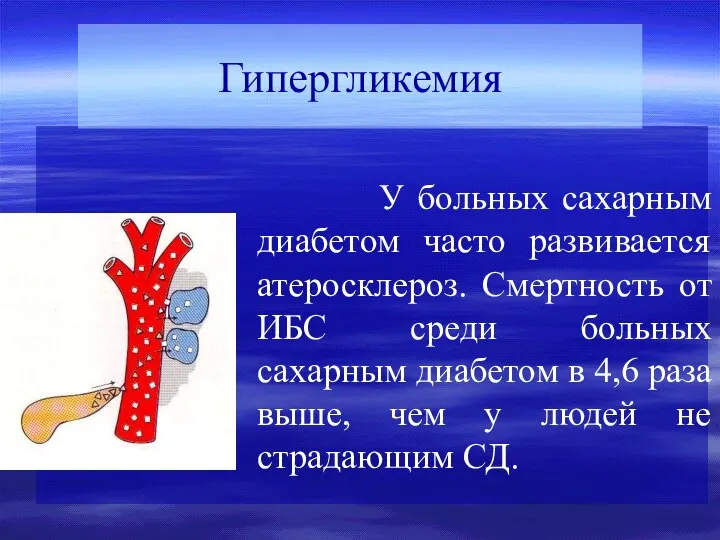 У больных сахарным диабетом часто развивается атеросклероз. Смертность от ИБС среди