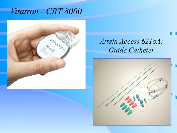 Vitatron - CRT 8000 Attain Access 6218A; Guide Catheter