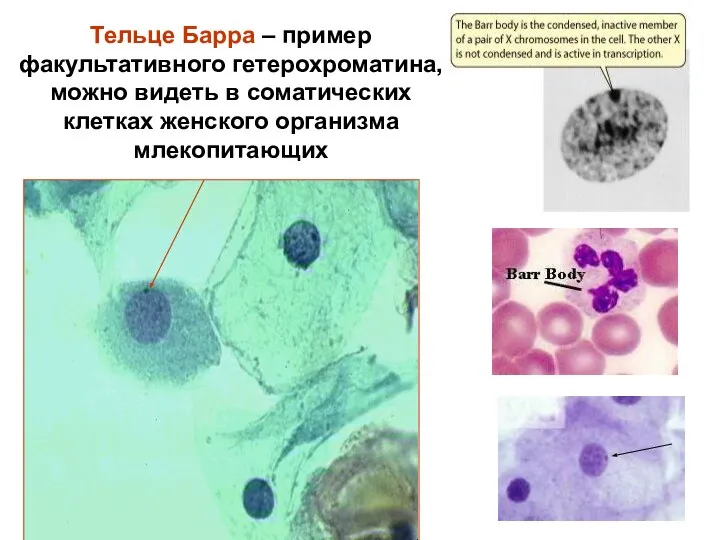 Тельце Барра – пример факультативного гетерохроматина, можно видеть в соматических клетках женского организма млекопитающих