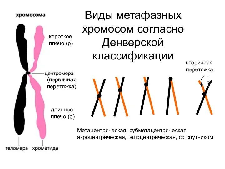Виды метафазных хромосом согласно Денверской классификации Метацентрическая, субметацентрическая, акроцентрическая, телоцентрическая, со