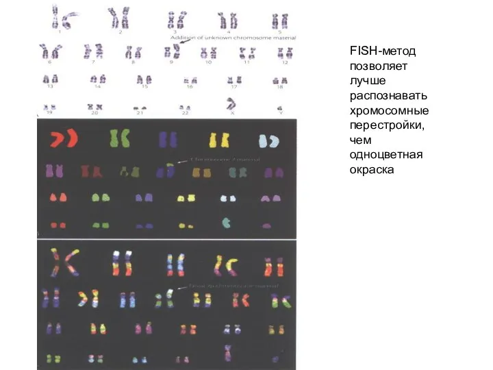 FISH-метод позволяет лучше распознавать хромосомные перестройки, чем одноцветная окраска