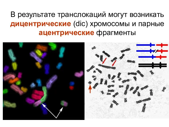 В результате транслокаций могут возникать дицентрические (dic) хромосомы и парные ацентрические фрагменты