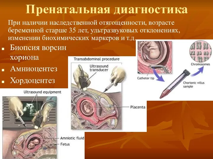 Пренатальная диагностика Биопсия ворсин хориона Амниоцентез Хордоцентез При наличии наследственной отягощенности,