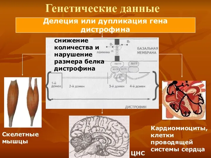 Генетические данные Делеция или дупликация гена дистрофина снижение количества и нарушение