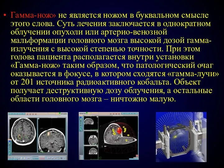 Гамма-нож» не является ножом в буквальном смысле этого слова. Суть лечения