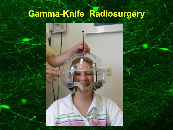 Gamma-Knife Radiosurgery