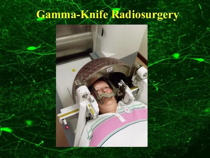 Gamma-Knife Radiosurgery