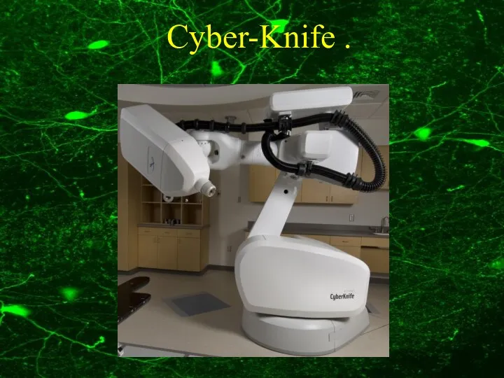 Cyber-Knife .