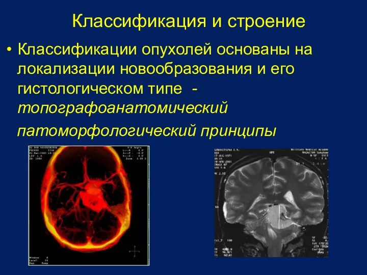 Классификация и строение Классификации опухолей основаны на локализации новообразования и его гистологическом типе -топографоанатомический патоморфологический принципы