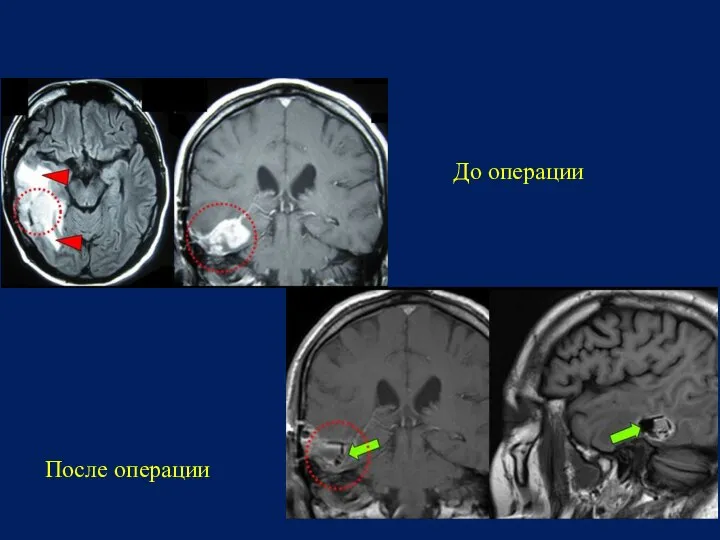До операции После операции